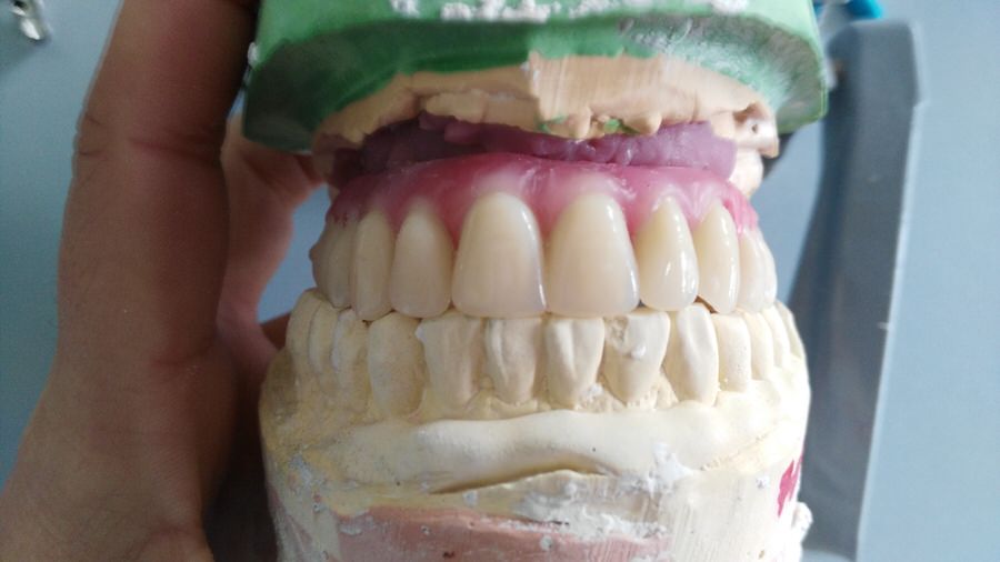 Prueba de dientes 1