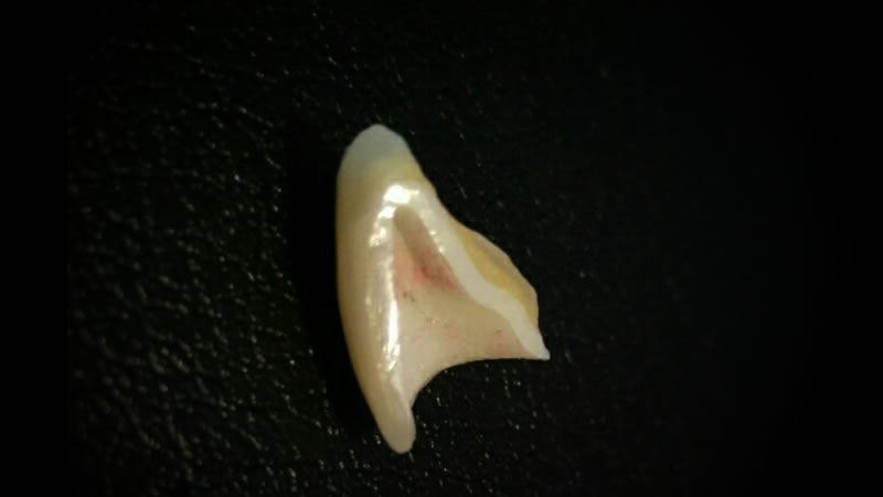 zi