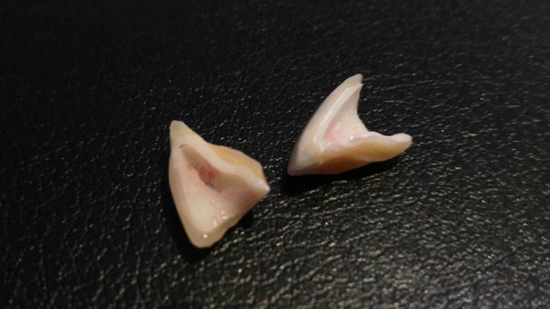 zi